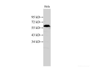 Western Blot analysis of HeLa cell using PKM Polyclonal Antibody at dilution of 1:500