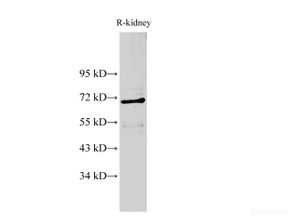 Western Blot analysis of Rat kidney using AIFM1 Polyclonal Antibody at dilution of 1:500