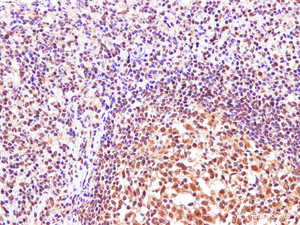 Immunohistochemistry of paraffin-embedded Human tonsil using CBX5 Polyclonal Antibody at dilution of 1:100