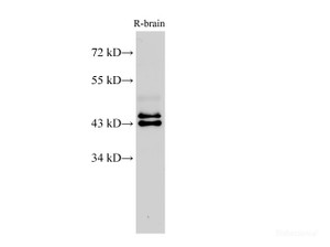 Western Blot analysis of Rat brain using ERK1/2 Polyclonal Antibody at dilution of 1:500