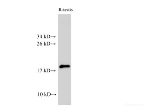 Western Blot analysis of Rat testis using Ak6 Polyclonal Antibody at dilution of 1:2000