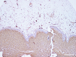 Immunohistochemistry of paraffin-embedded Human cervix using S100A8 Polyclonal Antibody at dilution of 1:100 (100×)