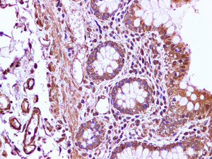 Immunohistochemistry of paraffin-embedded Human colon using Cyclin A2 Polyclonal Antibody at dilution of 1:100