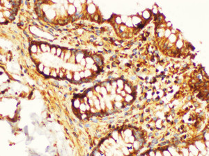 Immunohistochemistry of paraffin-embedded Human colon using KLK6 Ployclonal Antibody at dilution of 1:200.