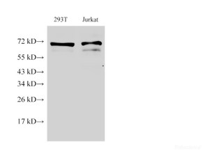 Western Blot analysis of 1) 293T, 2) Jurkat using ENG Ployclonal Antibody at dilution of 1:500.