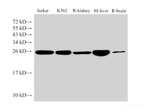 Western Blot analysis of Jurkat, K562, Rat kidney, Mouse liver and Rat brain using GSTP1 Polyclonal Antibody at dilution of 1:1000