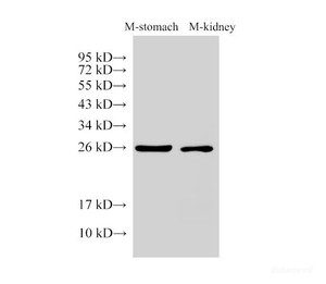 Western Blot analysis of Mouse stomach and Mouse kidney using GSTA1 Polyclonal Antibody at dilution of 1:3000