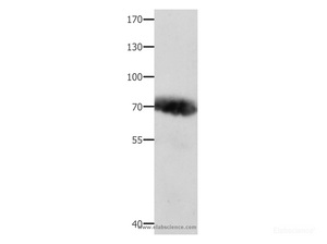 Western Blot analysis of Human liver cancer tissue using AFP Polyclonal Antibody at dilution of 1:800