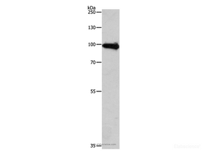 Western Blot analysis of Human fetal brain tissue using APLP1 Polyclonal Antibody at dilution of 1:650