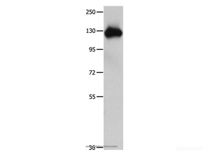 Western Blot analysis of Mouse lung tissue using Amphiphysin I Polyclonal Antibody at dilution of 1:400