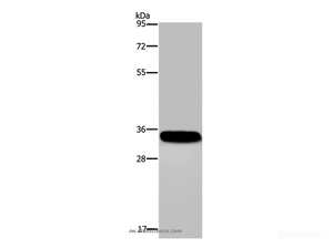 Western Blot analysis of Human normal lung tissue using CA4 Polyclonal Antibody at dilution of 1:300