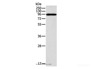 Western Blot analysis of A431 cell using CTNNA1 Polyclonal Antibody at dilution of 1:600