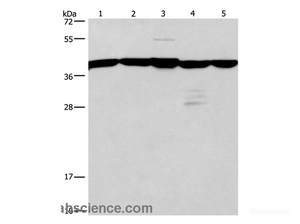 Western Blot analysis of A172 and 293T cell, Mouse kidney tissue, Human testis and brain malignant glioma tissue using GNA13 Polyclonal Antibody at dilution of 1:600