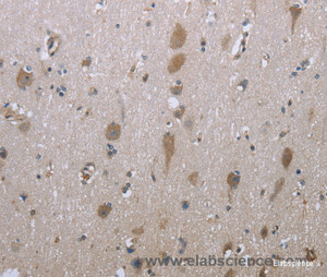 Immunohistochemistry of paraffin-embedded Human brain tissue using GPC6 Polyclonal Antibody at dilution 1:40