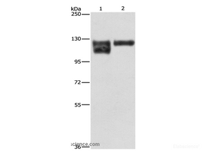Western Blot analysis of A172 cell and Human leiomyosarcoma tissue using ITGB1 Polyclonal Antibody at dilution of 1:600