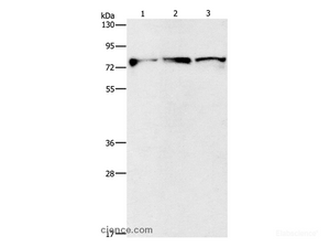 Western Blot analysis of Mouse brain and Human fetal brain tissue, Human brain malignant glioma tissue using KIF3A Polyclonal Antibody at dilution of 1:500