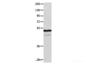 Western Blot analysis of Mouse thymus tissue using NAP1L1 Polyclonal Antibody at dilution of 1:1000