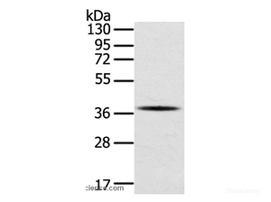 Western Blot analysis of A375 cell using SPARC Polyclonal Antibody at dilution of 1:400