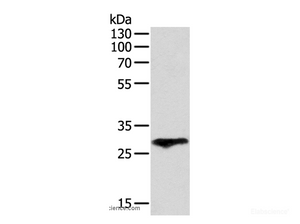 Western Blot analysis of Human fetal lung tissue using F3 Polyclonal Antibody at dilution of 1:400