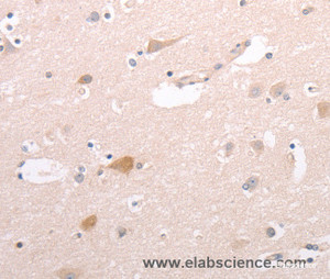 Immunohistochemistry of paraffin-embedded Human brain tissue using CIDEB Polyclonal Antibody at dilution 1:50