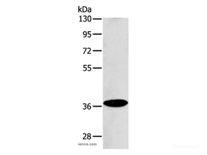 Western Blot analysis of Raji cell using ACMSD Polyclonal Antibody at dilution of 1:400