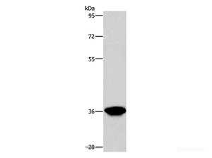 Western Blot analysis of Human liver cancer tissue using AKR1D1 Polyclonal Antibody at dilution of 1:650