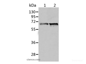 Western Blot analysis of Human fetal liver and liver cancer tissue using ALDH4A1 Polyclonal Antibody at dilution of 1:450