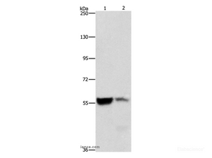 Western Blot analysis of Mouse liver and kidney tissue using ALDH8A1 Polyclonal Antibody at dilution of 1:550