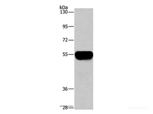 Western Blot analysis of Human plasma tissue using AHSG Polyclonal Antibody at dilution of 1:1450