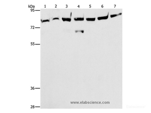 Western Blot analysis of A172 cell and Mouse brain tissue, K562, 231, A549, hela and hepG2 cell using PKC epsilon Polyclonal Antibody at dilution of 1:400