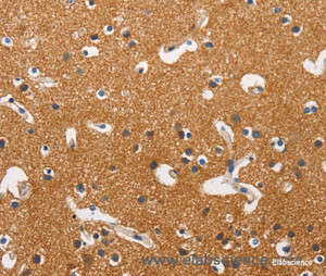 Immunohistochemistry of paraffin-embedded Human brain tissue using HK2 Polyclonal Antibody at dilution 1:40