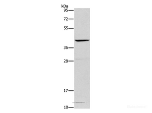 Western Blot analysis of Mouse liver tissue using ORM2 Polyclonal Antibody at dilution of 1:500