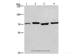 Western Blot analysis of Human fetal liver and Mouse stomach tissue, hela and hepG2 cell using ARNTL Polyclonal Antibody at dilution of 1:450