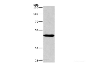 Western Blot analysis of A549 cell using BMP15 Polyclonal Antibody at dilution of 1:266.7