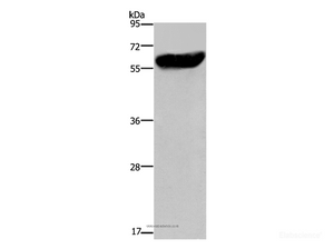 Western Blot analysis of Mouse liver tissue using CYP2E1 Polyclonal Antibody at dilution of 1:300