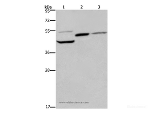 Western Blot analysis of Mouse heart, kidney and liver tissue using CYR61 Polyclonal Antibody at dilution of 1:350