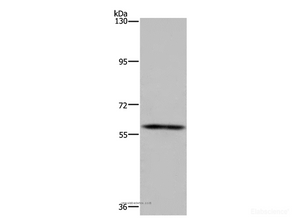 Western Blot analysis of Human fetal brain tissue using FTO Polyclonal Antibody at dilution of 1:650