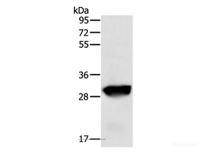 Western Blot analysis of Human liver cancer tissue using GSTO1 Polyclonal Antibody at dilution of 1:200