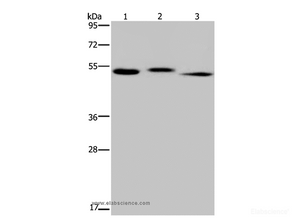 Western Blot analysis of Human kidney tissue, HepG2 cell and Human testis tissue using HYAL3 Polyclonal Antibody at dilution of 1:400