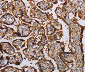 Immunohistochemistry of paraffin-embedded Human placenta tissue using KIF1C Polyclonal Antibody at dilution 1:60