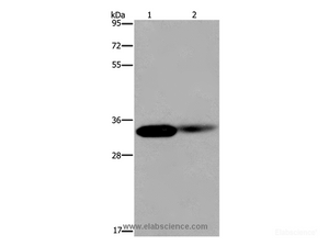 Western Blot analysis of Human kidney and Mouse lung tissue using LIMS1 Polyclonal Antibody at dilution of 1:200