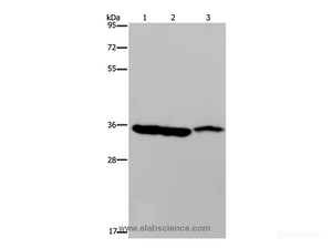 Western Blot analysis of Mouse heart, liver and stomach tissue using MDH1 Polyclonal Antibody at dilution of 1:500