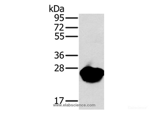 Western Blot analysis of Mouse heart tissue using MYL3 Polyclonal Antibody at dilution of 1:650
