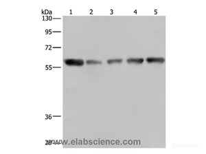 Western Blot analysis of Hela cell and Human brain malignant glioma tissue, NIH/3T3, PC3 and A549 cell using NUP62 Polyclonal Antibody at dilution of 1:300