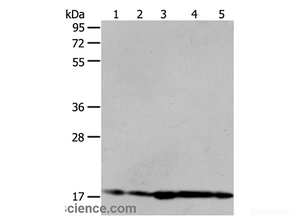 Western Blot analysis of Hela and 293T cell, Mouse liver tissue, A431 and MCF-7 cell using ARF6 Polyclonal Antibody at dilution of 1:450