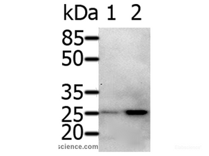 Western Blot analysis of 231 cell and Human fetal brain tissue using RAB5A Polyclonal Antibody at dilution of 1:600