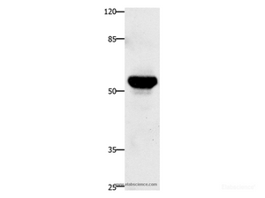 Western Blot analysis of Human fetal brain tissue using TNFRSF21 Polyclonal Antibody at dilution of 1:420