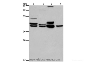 Western Blot analysis of 293T cell and Human brain malignant glioma tissue, Mouse brain and Human hepatocellular carcinoma tissue using ERK1/2 Polyclonal Antibody at dilution of 1:550