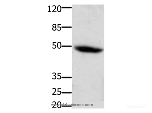 Western Blot analysis of Mouse heart tissue using CD116 Polyclonal Antibody at dilution of 1:400