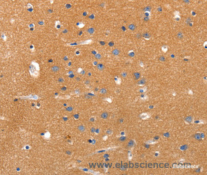 Immunohistochemistry of paraffin-embedded Human brain tissue using JAK2 Polyclonal Antibody at dilution 1:35